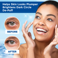FRAN WILSON Nourish My Eyes Hyaluronic (01297-000) Eye Pads 36 Pads