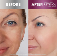 RETINOL Advanced Brightening Serum [46417-000]
